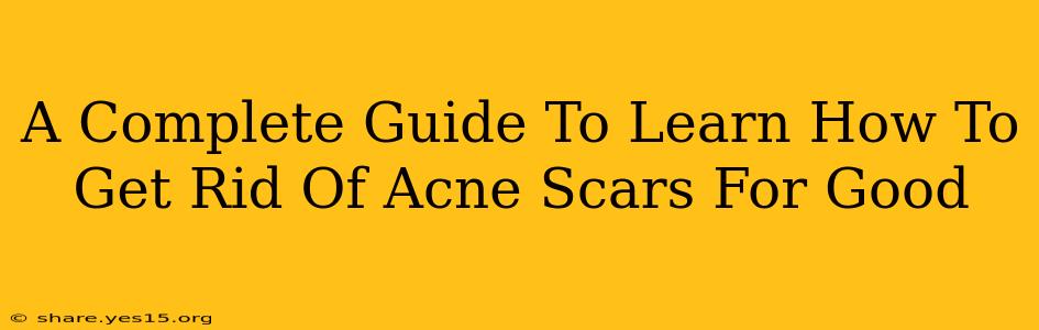 A Complete Guide To Learn How To Get Rid Of Acne Scars For Good